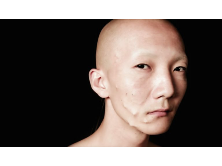 八島良子　Undergo　2015